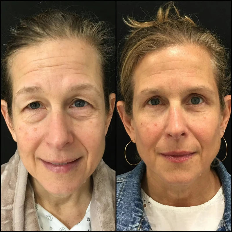 Customer before-and-after eye-care result