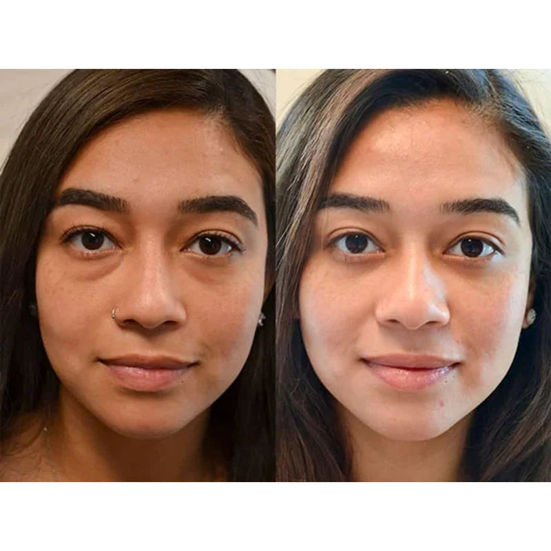 Customer before-and-after eye-care result