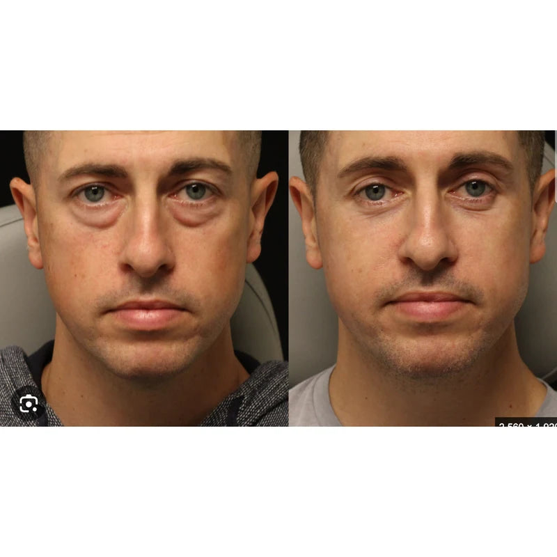Customer before-and-after eye-care result